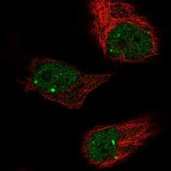 Invitrogen&trade;&nbsp;ZBTB5 Polyclonal Antibody