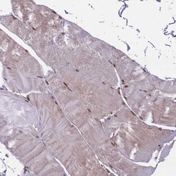 Invitrogen ZBTB5 Polyclonal Antibody 100 &mu;L | Buy Online | Invitrogen&trade; | Fisher Scientific