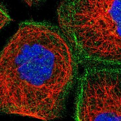 LRCH1 Polyclonal Antibody:Antibodies, Polyclonal
