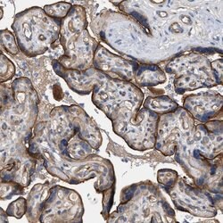 LRCH1 Polyclonal Antibody:Antibodies, Polyclonal
