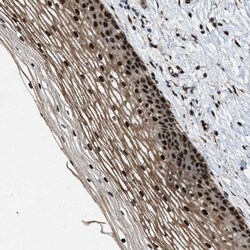 ZBTB10 Polyclonal Antibody:Antibodies, Polyclonal