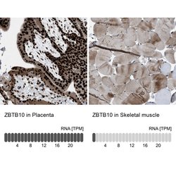 ZBTB10 Polyclonal Antibody:Antibodies, Polyclonal