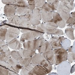 ZBTB10 Polyclonal Antibody:Antibodies, Polyclonal