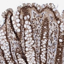 Invitrogen SMCR8 Polyclonal Antibody 100 &mu;L; Unconjugated:Antibodies,