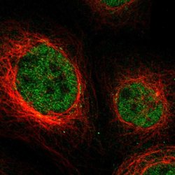 Invitrogen NPLOC4 Polyclonal Antibody 100 &mu;L; Unconjugated:Antibodies,