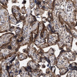 Invitrogen NPLOC4 Polyclonal Antibody 100 &mu;L; Unconjugated:Antibodies,
