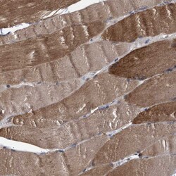 Invitrogen NPLOC4 Polyclonal Antibody 100 &mu;L; Unconjugated:Antibodies,