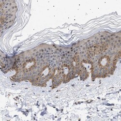 Invitrogen NPLOC4 Polyclonal Antibody 100 &mu;L; Unconjugated:Antibodies,