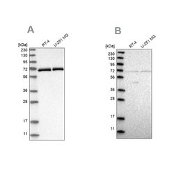 Invitrogen NPLOC4 Polyclonal Antibody 100 &mu;L; Unconjugated:Antibodies,