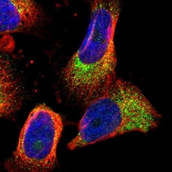 Invitrogen PHLP Polyclonal Antibody 100 &mu;L; Unconjugated:Antibodies,