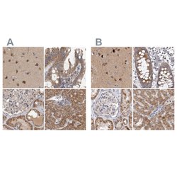 Invitrogen SCO1 Polyclonal Antibody 100 &mu;L; Unconjugated:Antibodies,