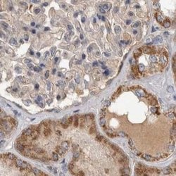 Invitrogen SCO1 Polyclonal Antibody 100 &mu;L; Unconjugated:Antibodies,