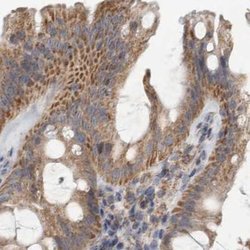 Invitrogen SCO1 Polyclonal Antibody 100 &mu;L; Unconjugated:Antibodies,
