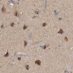 Invitrogen SCO1 Polyclonal Antibody 100 &mu;L; Unconjugated:Antibodies,