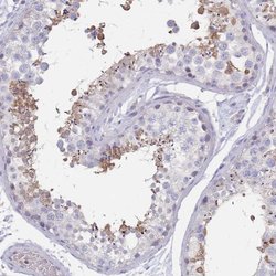 Invitrogen RAB11FIP4 Polyclonal Antibody 100 &mu;L; Unconjugated:Antibodies,