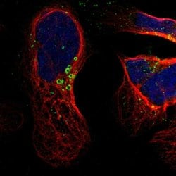 Invitrogen HSD17B11 Polyclonal Antibody 100 &mu;L; Unconjugated:Antibodies,