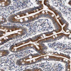 Invitrogen HSD17B11 Polyclonal Antibody 100 &mu;L; Unconjugated:Antibodies,