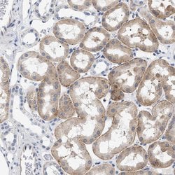 Invitrogen HSD17B11 Polyclonal Antibody 100 &mu;L; Unconjugated:Antibodies,