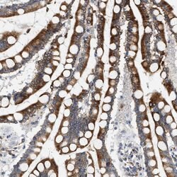 Invitrogen HSD17B11 Polyclonal Antibody 100 &mu;L; Unconjugated:Antibodies,