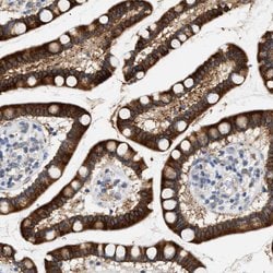 Invitrogen HSD17B11 Polyclonal Antibody 100 &mu;L; Unconjugated:Antibodies,