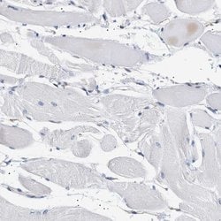 Invitrogen HSD17B11 Polyclonal Antibody 100 &mu;L; Unconjugated:Antibodies,