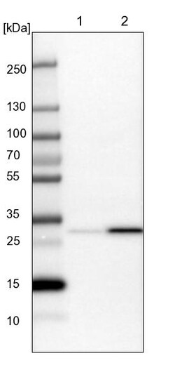 Invitrogen C17orf25 Polyclonal Antibody 100 &mu;L | Buy Online | Invitrogen&trade; | Fisher Scientific