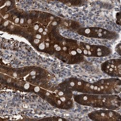 Invitrogen C17orf25 Polyclonal Antibody 100 &mu;L | Buy Online | Invitrogen&trade; | Fisher Scientific