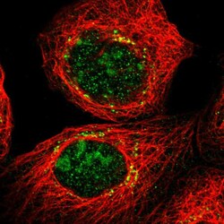 Invitrogen CYB5D1 Polyclonal Antibody 100 &mu;L; Unconjugated:Antibodies,