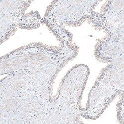 RCOR2 Polyclonal Antibody:Antibodies, Polyclonal