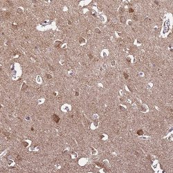 RCOR2 Polyclonal Antibody:Antibodies, Polyclonal