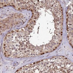 RCOR2 Polyclonal Antibody:Antibodies, Polyclonal