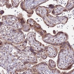 RCOR2 Polyclonal Antibody:Antibodies, Polyclonal