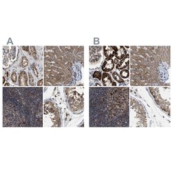 Invitrogen CCDC44 Polyclonal Antibody 100 &mu;L; Unconjugated:Antibodies,