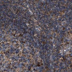 Invitrogen CCDC44 Polyclonal Antibody 100 &mu;L; Unconjugated:Antibodies,