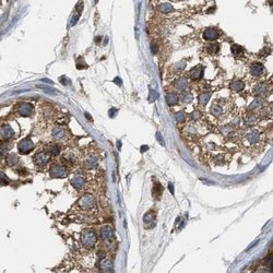 Invitrogen CCDC44 Polyclonal Antibody 100 &mu;L; Unconjugated:Antibodies,