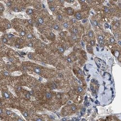 Invitrogen CCDC44 Polyclonal Antibody 100 &mu;L; Unconjugated:Antibodies,