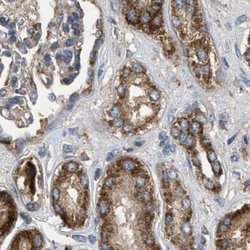 Invitrogen CCDC44 Polyclonal Antibody 100 &mu;L; Unconjugated:Antibodies,