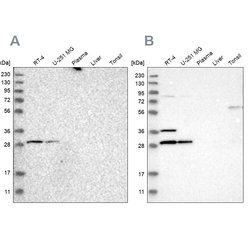 Invitrogen CCDC44 Polyclonal Antibody 100 &mu;L; Unconjugated:Antibodies,