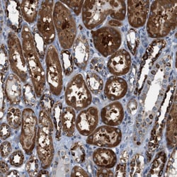 Invitrogen PHLP Polyclonal Antibody 100 &mu;L; Unconjugated:Antibodies,