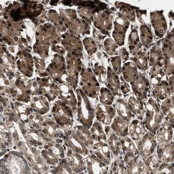 ACCS Polyclonal Antibody:Antibodies, Polyclonal