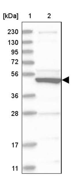 Invitrogen P3 Polyclonal Antibody 100 &mu;L; Unconjugated:Antibodies, Polyclonal
