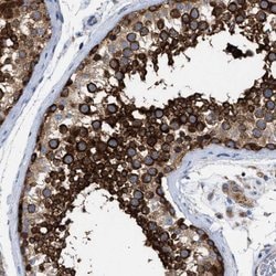 Invitrogen VPS13A Polyclonal Antibody 100 &mu;L; Unconjugated:Antibodies,