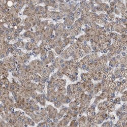 Invitrogen VPS13A Polyclonal Antibody 100 &mu;L; Unconjugated:Antibodies,