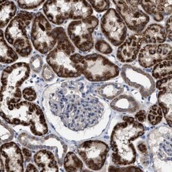 Invitrogen VPS13A Polyclonal Antibody 100 &mu;L; Unconjugated:Antibodies,