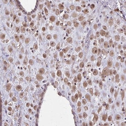 NRBF2 Polyclonal Antibody:Antibodies, Polyclonal
