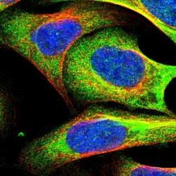 UBAP2 Polyclonal Antibody:Antibodies, Polyclonal