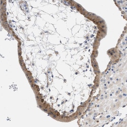 UBAP2 Polyclonal Antibody:Antibodies, Polyclonal