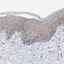UBAP2 Polyclonal Antibody:Antibodies, Polyclonal