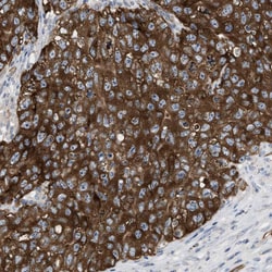 UBAP2 Polyclonal Antibody:Antibodies, Polyclonal