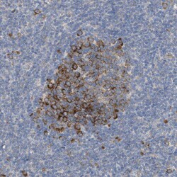 UBAP2 Polyclonal Antibody:Antibodies, Polyclonal